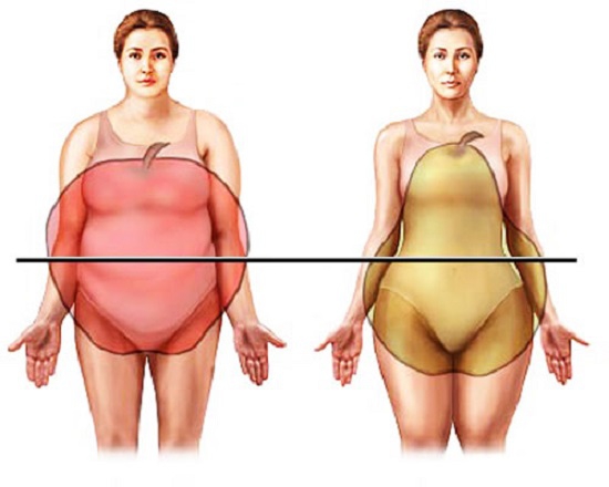 Типы женского ожирения