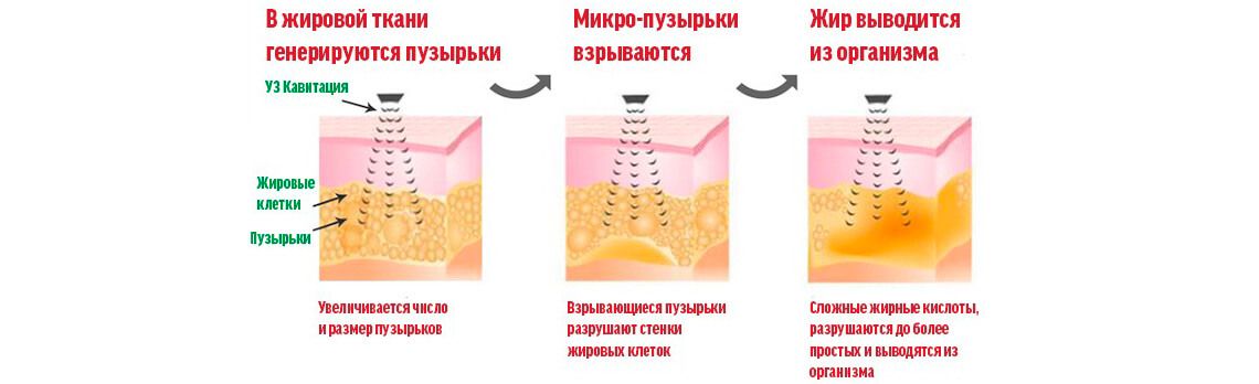 Кавитация в картинках